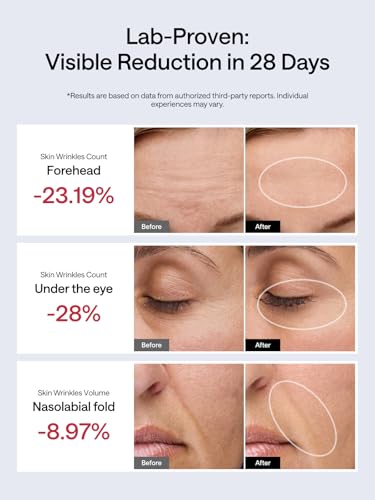 Facial Toning Device, Microcurrent Facial Device, Red Light Therapy, 4 Modes, 5 Intensity Levels R716630