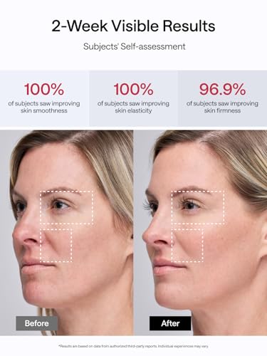 Facial Toning Device, Microcurrent Facial Device, Red Light Therapy, 4 Modes, 5 Intensity Levels R716630